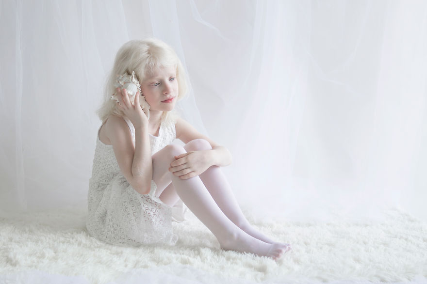 Фотография: Гипнотическая красота альбиносов в фотопроекте Юлии Тайц №11 - BigPicture.ru