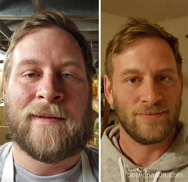 Фотография: До и после: как меняется внешность человека, который перестает пить №22 - BigPicture.ru