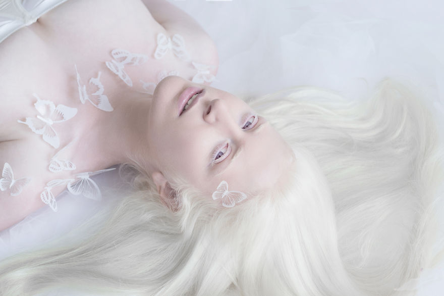 Фотография: Гипнотическая красота альбиносов в фотопроекте Юлии Тайц №2 - BigPicture.ru