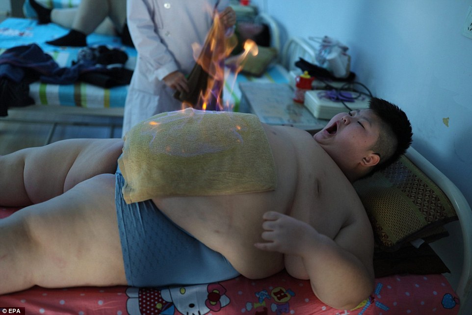 Фотография: 11-летний китаец весом 150 килограммов пытается похудеть с помощью огня №1 - BigPicture.ru