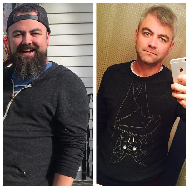 Фотография: До и после: как меняется внешность человека, который перестает пить №21 - BigPicture.ru