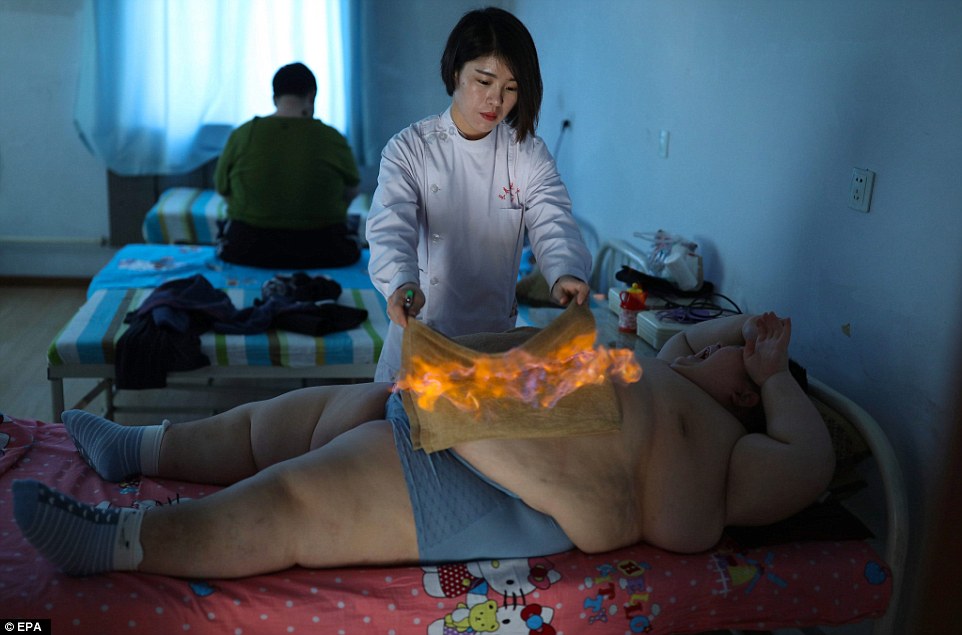 Фотография: 11-летний китаец весом 150 килограммов пытается похудеть с помощью огня №3 - BigPicture.ru