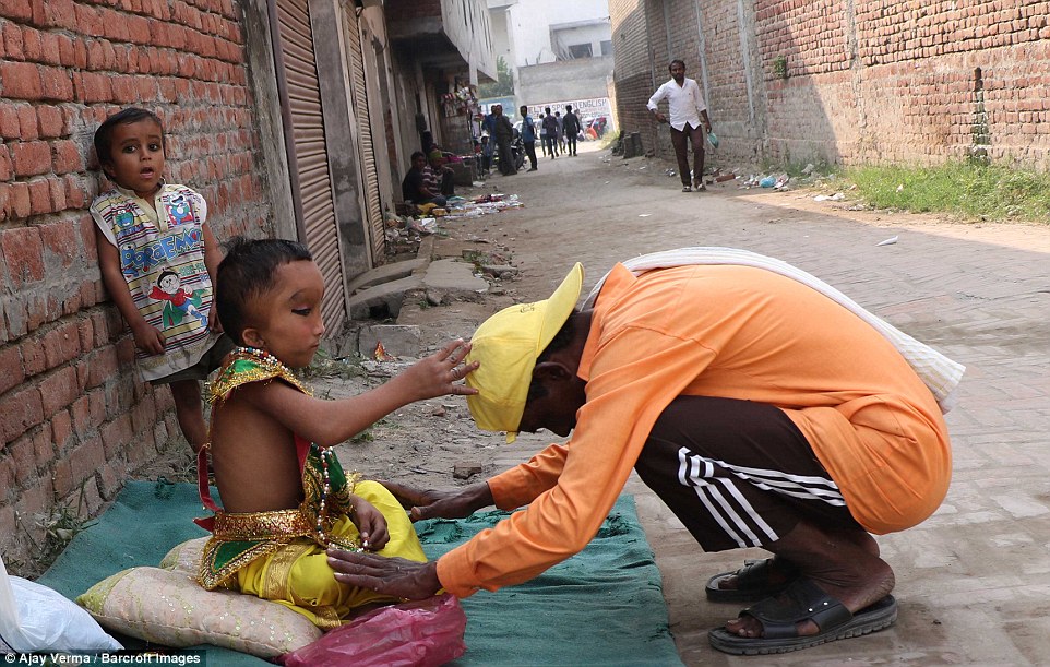 Фотография: Жители индийской деревни поклоняются мальчику с деформированной головой как богу Ганеше №3 - BigPicture.ru