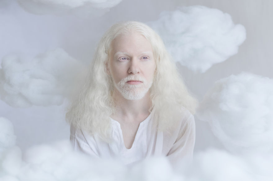 Фотография: Гипнотическая красота альбиносов в фотопроекте Юлии Тайц №4 - BigPicture.ru