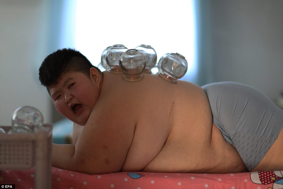 Фотография: 11-летний китаец весом 150 килограммов пытается похудеть с помощью огня №4 - BigPicture.ru