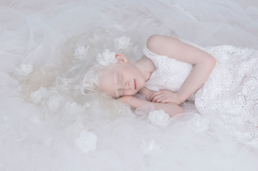 Фотография: Гипнотическая красота альбиносов в фотопроекте Юлии Тайц №5 - BigPicture.ru