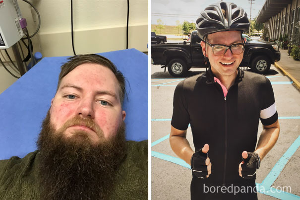 Фотография: До и после: как меняется внешность человека, который перестает пить №4 - BigPicture.ru