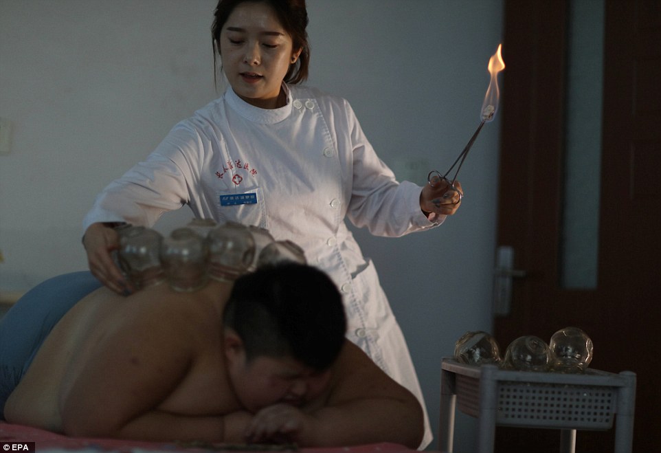 Фотография: 11-летний китаец весом 150 килограммов пытается похудеть с помощью огня №2 - BigPicture.ru