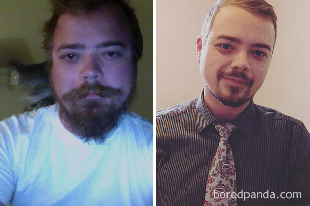 Фотография: До и после: как меняется внешность человека, который перестает пить №5 - BigPicture.ru