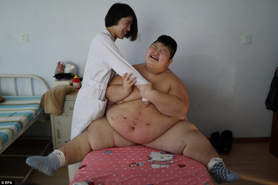 Фотография: 11-летний китаец весом 150 килограммов пытается похудеть с помощью огня №6 - BigPicture.ru