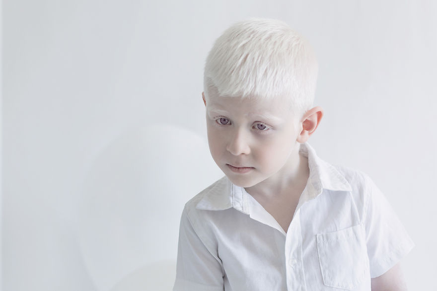 Фотография: Гипнотическая красота альбиносов в фотопроекте Юлии Тайц №10 - BigPicture.ru