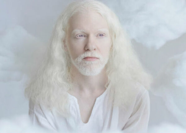 Гипнотическая красота альбиносов в фотопроекте Юлии Тайц