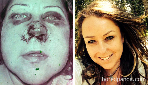 Фотография: Удивительное преображение людей после того, как они перестали принимать наркотики №10 - BigPicture.ru