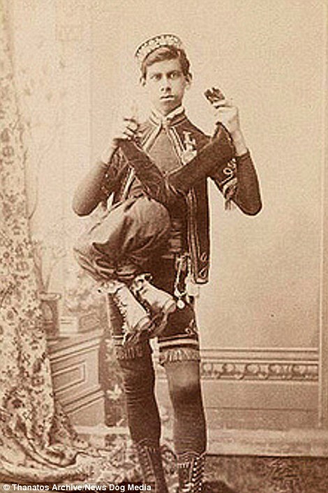 Фотография: Суровый XIX век: коллекция архивных фотографий людей с деформациями №12 - BigPicture.ru
