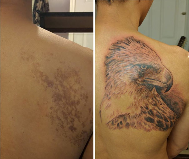 Фотография: Люди с родимыми пятнами, которые не растерялись и сделали их частью татуировок №15 - BigPicture.ru