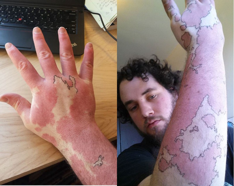 Фотография: Люди с родимыми пятнами, которые не растерялись и сделали их частью татуировок №2 - BigPicture.ru