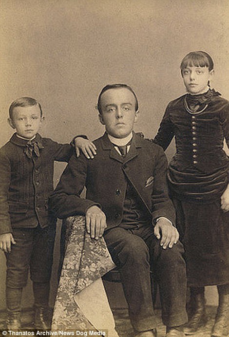 Фотография: Суровый XIX век: коллекция архивных фотографий людей с деформациями №6 - BigPicture.ru