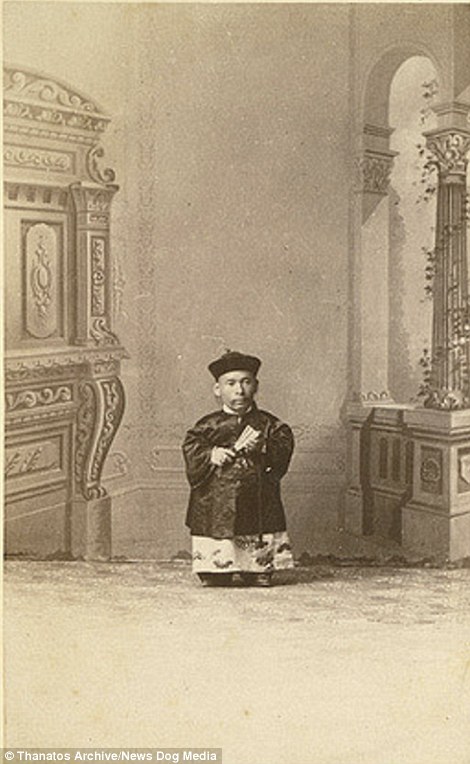 Фотография: Суровый XIX век: коллекция архивных фотографий людей с деформациями №10 - BigPicture.ru