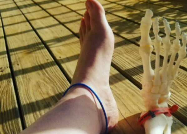 Американка ведет инстаграм с приключениями своей ампутированной ноги