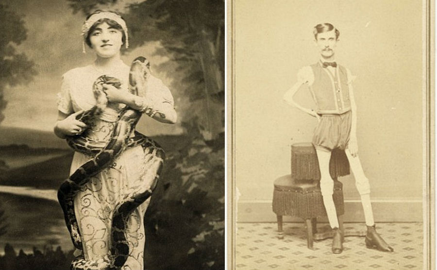 Суровый XIX век: коллекция архивных фотографий людей с деформациями