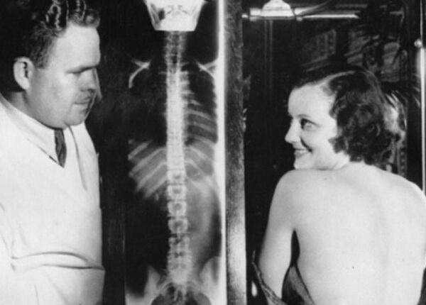 Видно историю насквозь: первые пациенты на рентгене