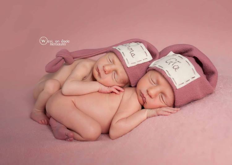 Фотография: Фотографии двух пар близнецов доказывают нерушимую силу любви между ними №4 - BigPicture.ru