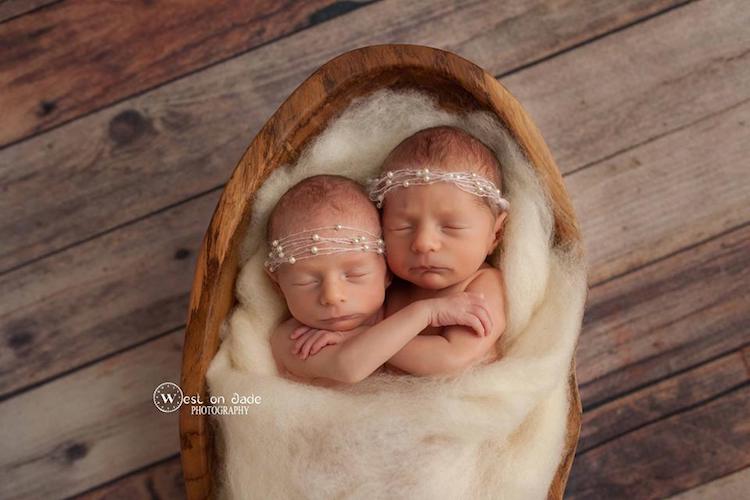 Фотография: Фотографии двух пар близнецов доказывают нерушимую силу любви между ними №6 - BigPicture.ru
