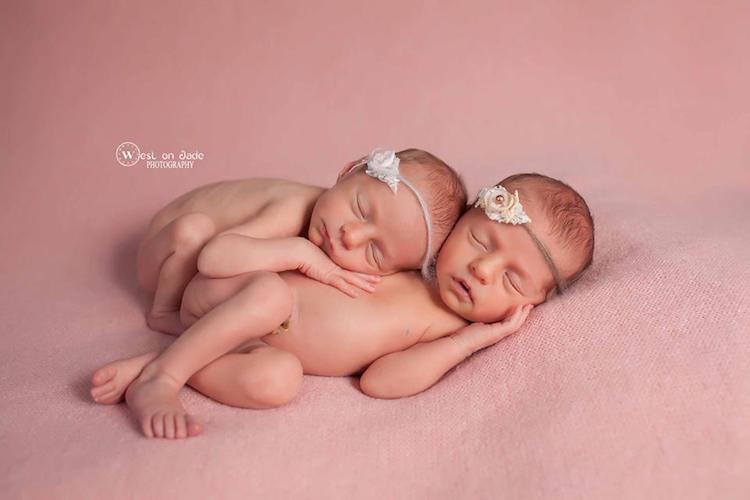 Фотография: Фотографии двух пар близнецов доказывают нерушимую силу любви между ними №7 - BigPicture.ru