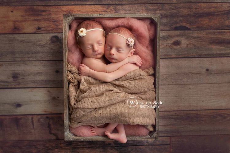 Фотография: Фотографии двух пар близнецов доказывают нерушимую силу любви между ними №8 - BigPicture.ru