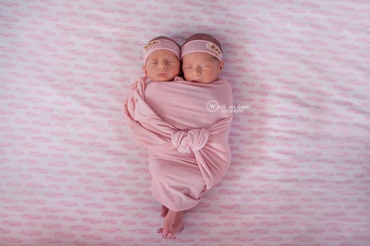 Фотография: Фотографии двух пар близнецов доказывают нерушимую силу любви между ними №9 - BigPicture.ru