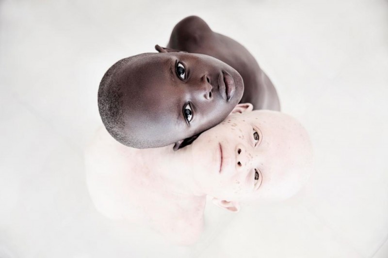 Фотография: Смертельная белизна: невероятные портреты альбиносов Танзании №1 - BigPicture.ru