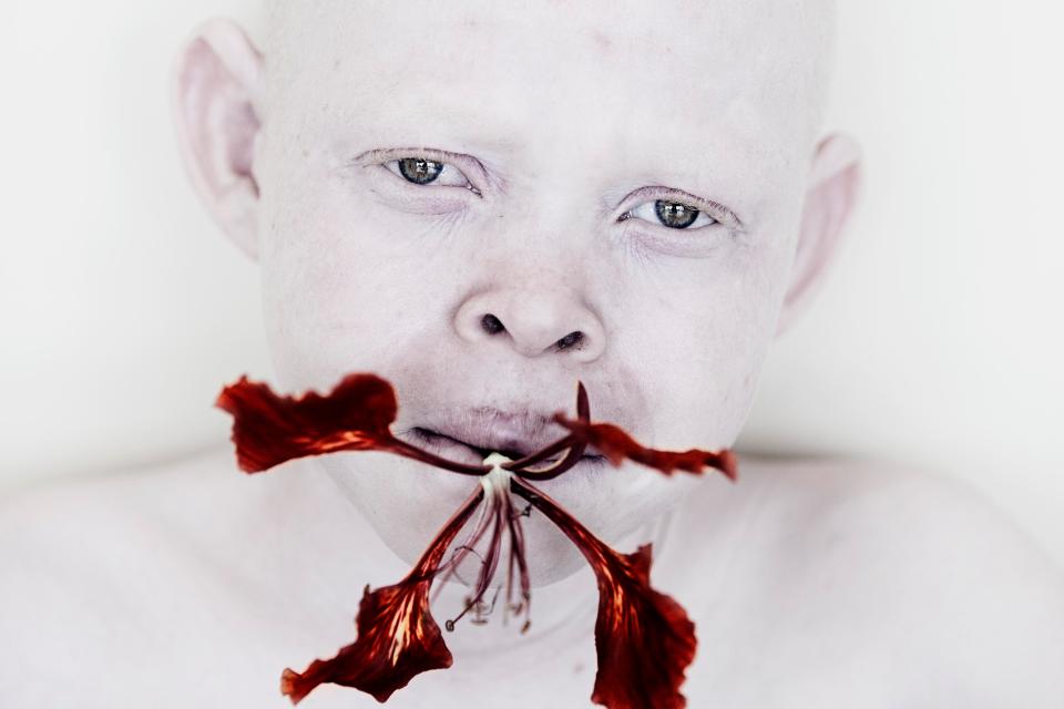 Фотография: Смертельная белизна: невероятные портреты альбиносов Танзании №4 - BigPicture.ru