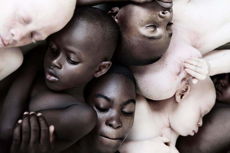 Фотография: Смертельная белизна: невероятные портреты альбиносов Танзании №5 - BigPicture.ru