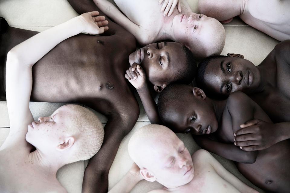 Фотография: Смертельная белизна: невероятные портреты альбиносов Танзании №9 - BigPicture.ru