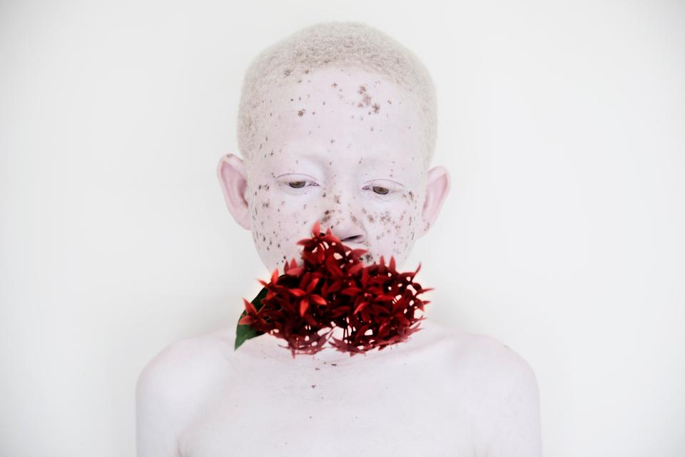 Фотография: Смертельная белизна: невероятные портреты альбиносов Танзании №15 - BigPicture.ru