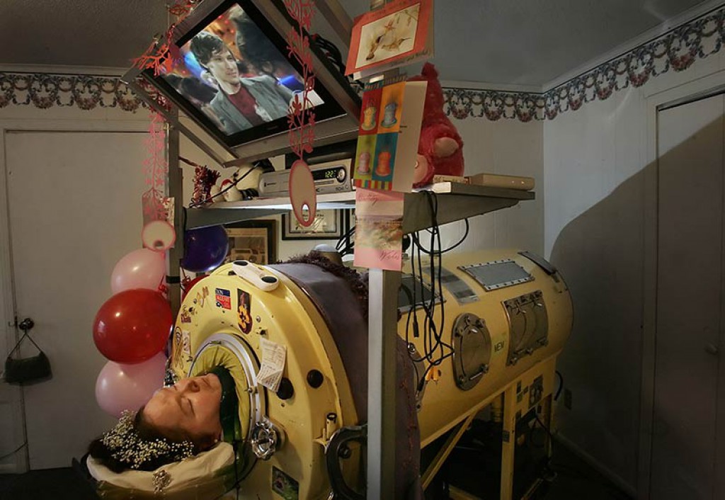 Американка Диана Оделл провела почти 60 лет в аппарате вентиляции легких