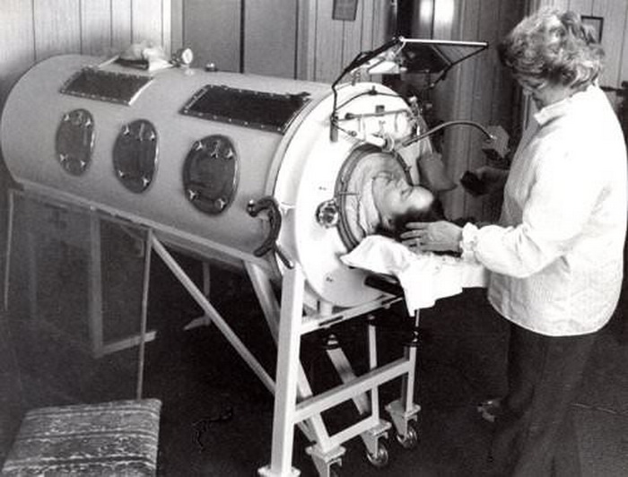 Американка Диана Оделл провела почти 60 лет в аппарате вентиляции легких