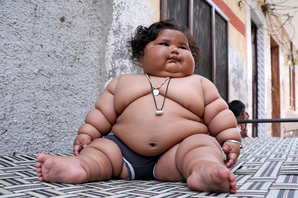 Фотография: 8-месячная девочка весит 17 килограммов, и врачи не могут поставить ей диагноз №1 - BigPicture.ru