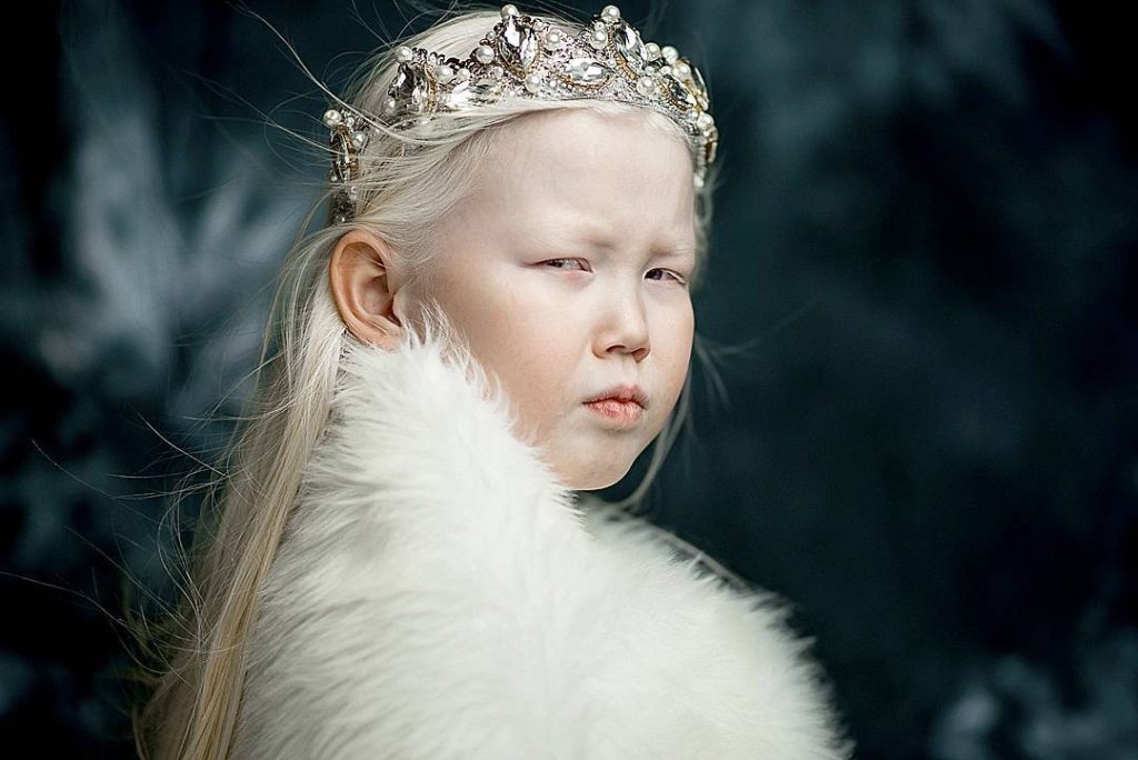 Фотография: Белоснежка из Сибири: 8-летняя модель с редчайшей внешностью потрясла интернет №6 - BigPicture.ru
