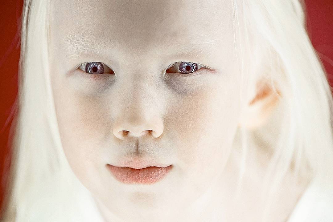 Фотография: Белоснежка из Сибири: 8-летняя модель с редчайшей внешностью потрясла интернет №3 - BigPicture.ru