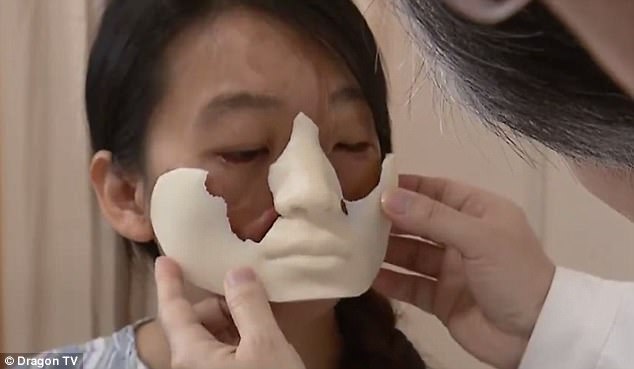 Фотография: Китаянке с деформированным лицом врачи выращивают новое лицо на груди №3 - BigPicture.ru