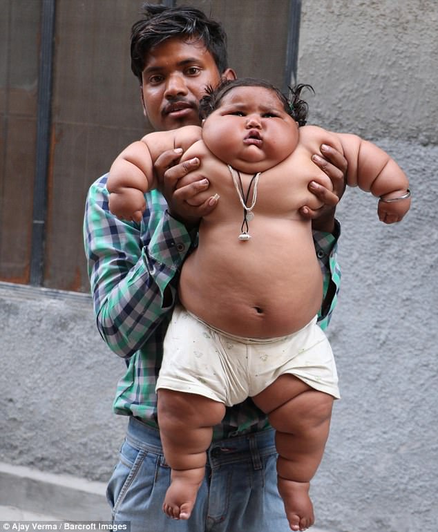 Фотография: 8-месячная девочка весит 17 килограммов, и врачи не могут поставить ей диагноз №3 - BigPicture.ru