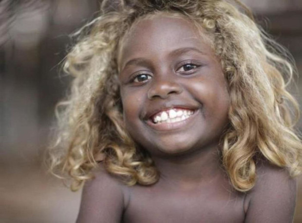 Фотография: Откуда в Меланезии взялись темнокожие люди со светлыми волосами №5 - BigPicture.ru