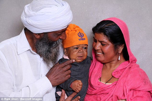 Фотография: Необъяснимая история 21-летнего индийца, который застрял в теле младенца №6 - BigPicture.ru