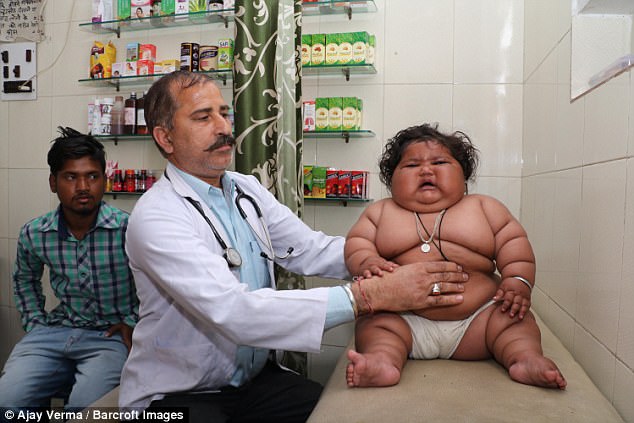 Фотография: 8-месячная девочка весит 17 килограммов, и врачи не могут поставить ей диагноз №7 - BigPicture.ru