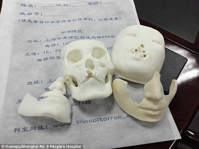 Фотография: Китаянке с деформированным лицом врачи выращивают новое лицо на груди №6 - BigPicture.ru