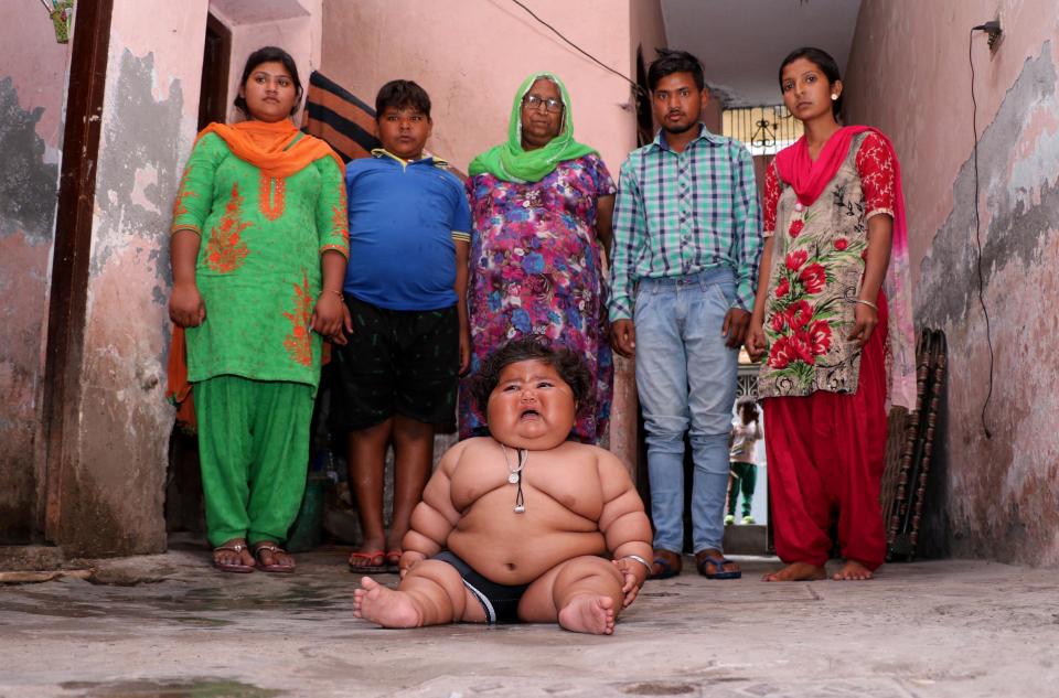 Фотография: 8-месячная девочка весит 17 килограммов, и врачи не могут поставить ей диагноз №2 - BigPicture.ru