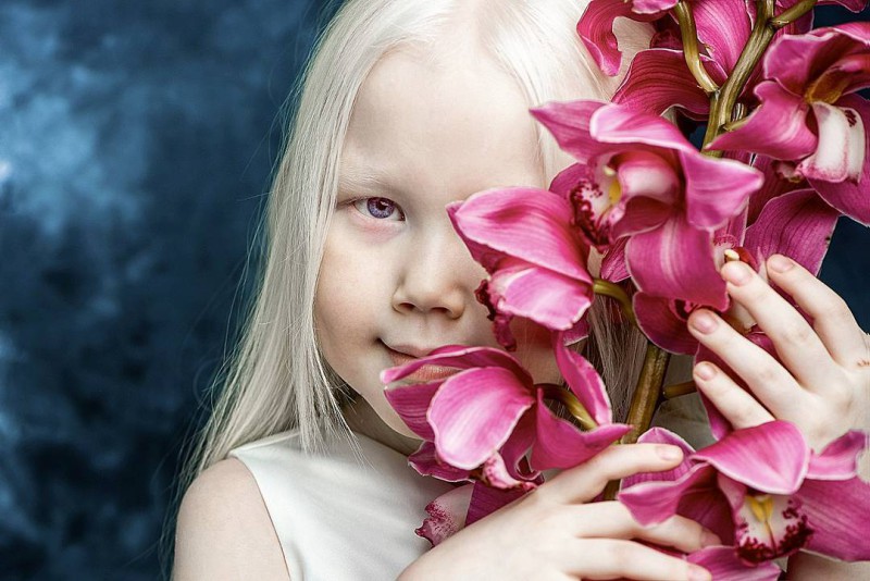Фотография: Белоснежка из Сибири: 8-летняя модель с редчайшей внешностью потрясла интернет №1 - BigPicture.ru