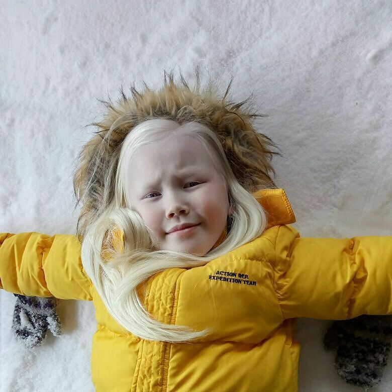 Фотография: Белоснежка из Сибири: 8-летняя модель с редчайшей внешностью потрясла интернет №4 - BigPicture.ru