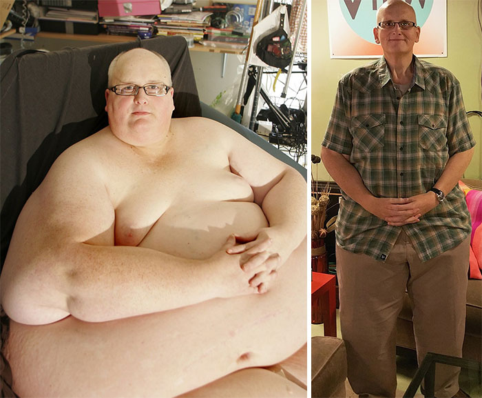 Фотография: До и после: 30 примеров невероятного преображения при похудении №15 - BigPicture.ru